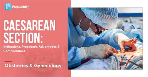 Causes of Caesarean Section