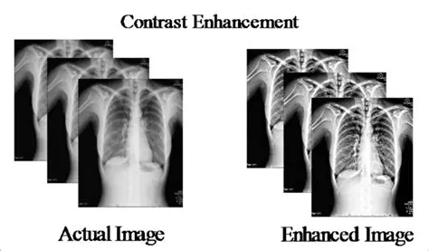 Contrast enhancement technique