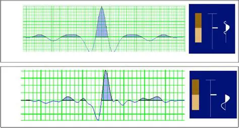 Generating Synthetic Seismograms