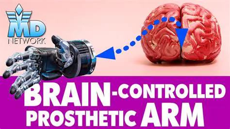 How Bionic Brain Implants Work