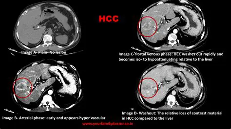 Key Features of HALFEN HCC