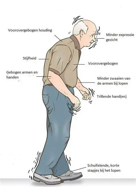 Parkinson: Symptomen, Oorzaken en Behandeling van de Ziekte