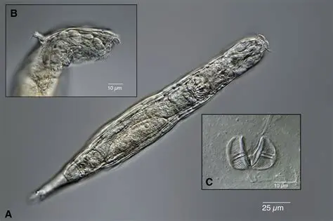 The Biology of Zombie Worms