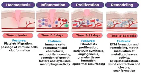 The Importance of Epithelialization in Burn Treatment