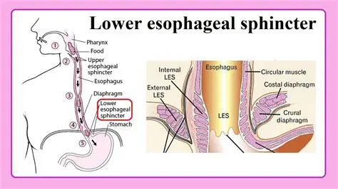 The Importance of the Lower Esophageal Sphincter