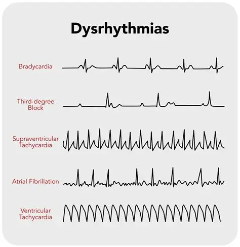 Understanding Anarchy Rhythms